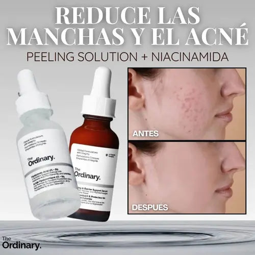 Kit The Ordinary Niacinamida + Peeling