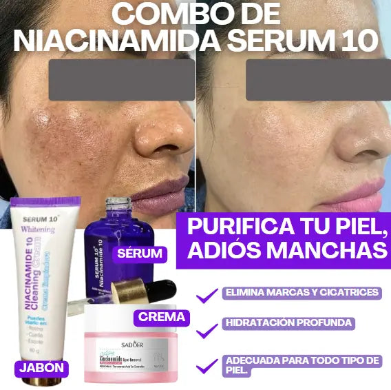 Purifica tu Piel, ¡Adiós Manchas!
